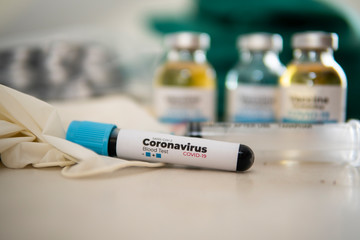 blood test result for the new rapidly spreading Coronavirus, originating in Wuhan, China