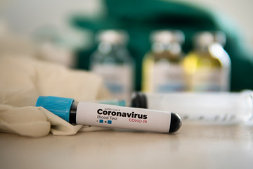 blood test result for the new rapidly spreading Coronavirus, originating in Wuhan, China