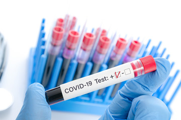 Obraz premium Coronavirus infectious concept - doctor holds in his hand sample blood COVID -19 positive test in the laboratory