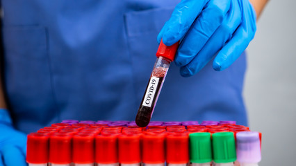 Researcher holding blood in test tube for checking Covid-19