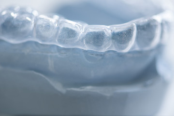 fablose Aufbissschiene gegen Zähneknirschen auf Gips Modell in der Zahnarzt Praxis - obrazy, fototapety, plakaty