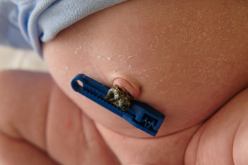 Close up shot of a newborn's baby belly button