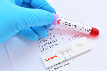 Fototapeta premium Positive test result by using rapid test device for COVID-19 virus, novel coronavirus 2019 found in Wuhan, China