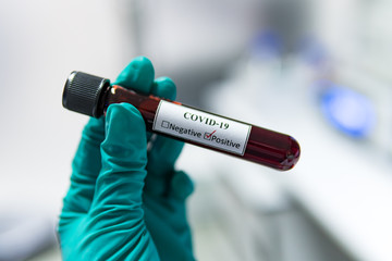 Scientist holding Test tube with blood sample for COVID-19 test,Experiment to detect virus was found in the blood.