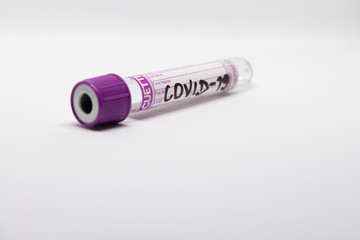 COVID- 19. Corona virus disease. Blood test. Stop dangerous Chinese virus COVID-19.Laboratory sample of blood testing for diagnosis new Corona virus infection.