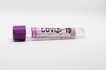 COVID- 19. Corona virus disease. Blood test. Stop dangerous Chinese virus COVID-19.Laboratory sample of blood testing for diagnosis new Corona virus infection.