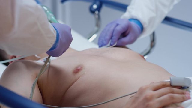 Doctors in Protective Suits Attaching ECG Leads to Coronavirus Patient - Medium Shot