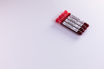 Blood samples tested for COVID-19 coronavirus - All patients tested positive for the aggressive virus. Space for text. Health concept.