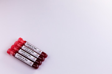 Blood samples tested for COVID-19 coronavirus - All patients tested positive for the aggressive virus. Space for copy. Health concept.