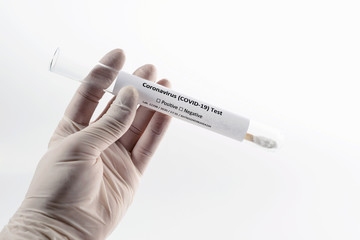 doctor’s hands holding a test tube with biological material or DNA of human infected with coronavirus. White background isolated close up