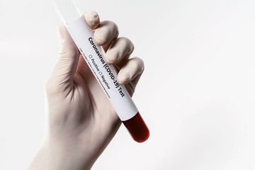 Naklejka premium Coronavirus Covid 19 infected blood sample in tube in hand of scientist doctor in medical gloves isolated at white background. Corona virus prevention