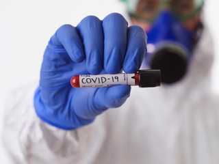 Coronavirus, Doctor holding positive covid-19 virus Blood Sample tube white background