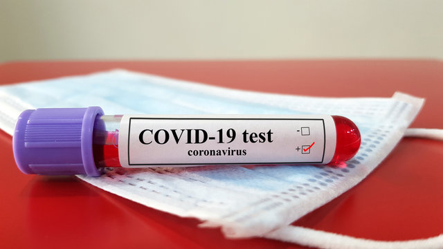 Positive COVID-19 test and laboratory sample of blood testing for diagnosis new Corona virus infection(novel corona virus disease 2019)from Wuhan with hospital background. Pandemic infectious concept