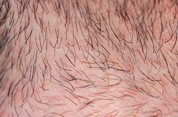 skin texture of a young man covered with hair and bristles of different colors and lengths