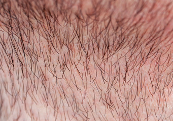 skin texture of a young man covered with hair and bristles of different colors and lengths
