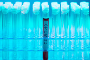 Laboratory tube with blood and virus. Scientific lab close-up. Pandemic disease, healthcare,...