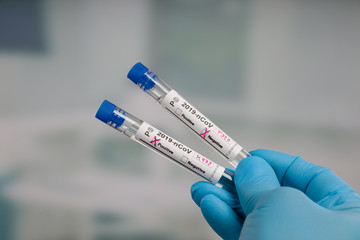 Obraz premium hand in blue gloves holding test tubes with analyis results in front of a lab room