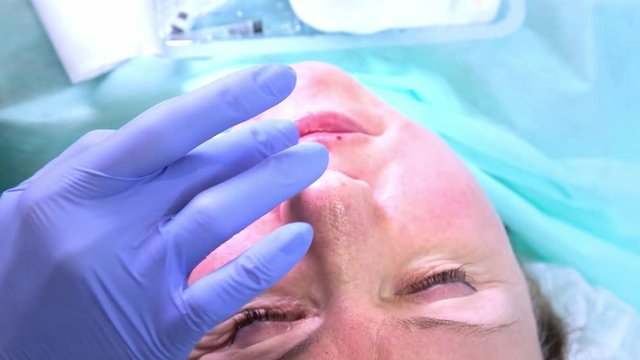 cosmetologist doctor prepares a woman's face for a cosmetic injectio , injections of hyaluronic acid. Woman in a beauty salon. plastic surgery clinic