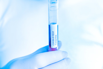 Coronavirus test concept. Covid 19. Arm in plastic gloves holding test tube with test sample in laboratory. Hand detail. Blue tone filter.