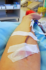volunteer Blood donor with surgical needle at the hospital