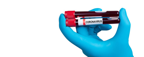 Coronavirus 2019-nCoV Blood Sample.