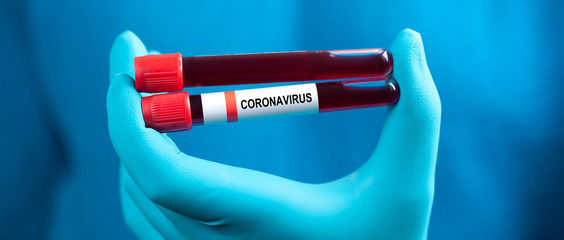Coronavirus 2019-nCoV Blood Sample.
