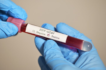 Obraz premium Coronavirus 2019-Ncov With Blood Test