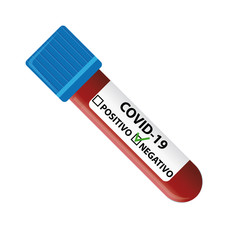 Covid-19 Coronavirus Blood Test. Negative result. Italian test.