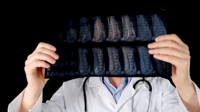 Front view of radiologist holding backbones x-ray. Professional medical worker inspecting x-ray on black background. Medicine concept