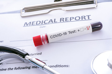 Coronavirus infectious concept - sample blood COVID -19 negative test on medical documentation records in the laboratory