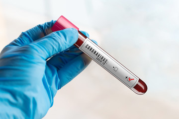 Obraz premium Positive result of the Coronavirus test, Covid-19.