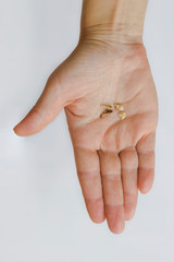 Torn out damaged tooth roots lie on the female palm