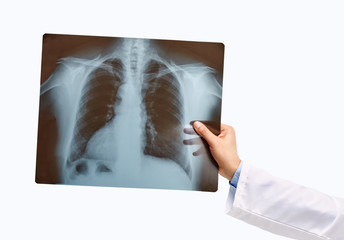 Man hand holding a lungs radiography isolated on a white background