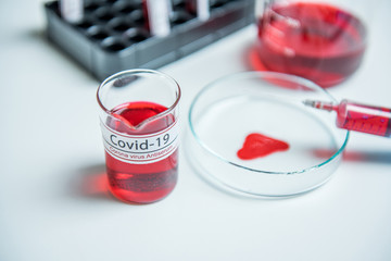 Coronavirus covid19 infected blood sample in sample tube on table in corona virus laboratory