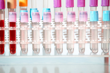 Test tubes. Medical equipment.Test tubes with colorful liquids in holder on table.