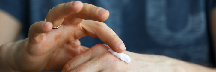 Male hands applying moistening cream on skin