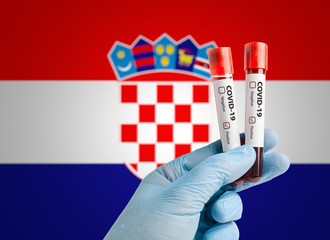 Pandemic COVID-19 concept: Scientist holding blood sample in test tubes with positive test result...