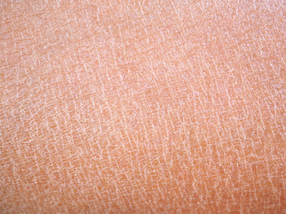 dry skin or ichthyosis texture detail in asian women using for moisturizer lotion, cream or beauty...
