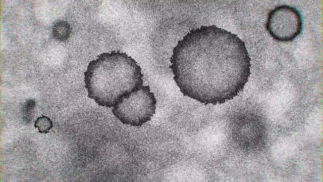 Corona (COVID-19) Virus Simulation