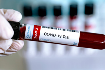 Testing for presence of coronavirus. Tube containing a blood sample for COVID-19.	