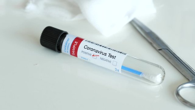 Testing for presence of coronavirus. Nurse writing a positive result on a tube containing a swab sample for COVID-19.