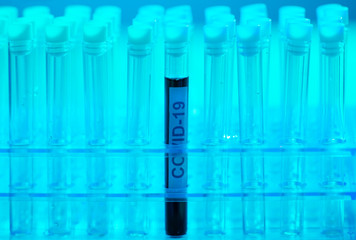 Laboratory tube with blood and virus. Scientific lab close-up. Pandemic disease, healthcare, vaccine research and coronavirus covid-19 test.