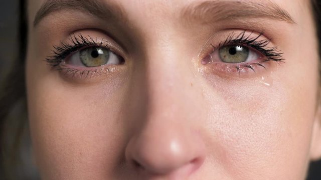 Watery eyes. Woman cries and looking at camera, flu, tonsillitis, colds, conjunctivitis, blepharitis, allergy, sinusitis, dacryocystitis, inversion of eyelids concepts. Front view. Close-up