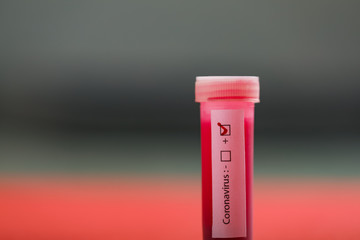 Positive COVID-19 test and laboratory sample of blood testing