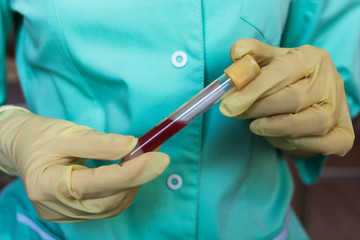 test tube for a blood test in the hand of a medic. Hands in gloves on the background of a medical gown. The concept of blood testing.