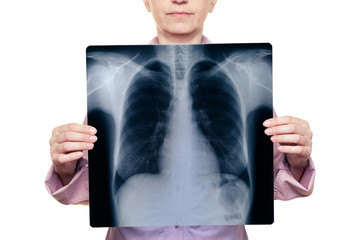 Woman holding a chest x-ray in front of her body