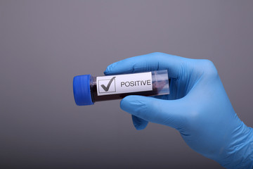Obraz premium Coronavirus 2019-nCoV Blood Sample. Corona virus outbreaking. Epidemic virus Respiratory Syndrome.