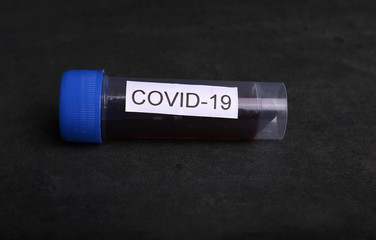 Coronavirus 2019-nCoV Blood Sample. Corona virus outbreaking. Epidemic virus Respiratory Syndrome.