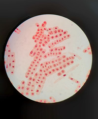 The mitosis cell of root tip onion under the light microscope. The cells were zoomed 40x.