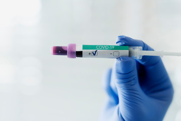 Obraz premium Positive medical result of coronavirus